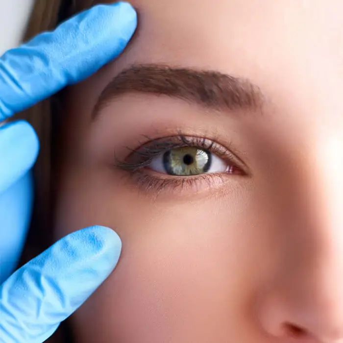 Refractive Lens Exchange